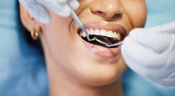 Best Teeth Whitening  in Portland, TX