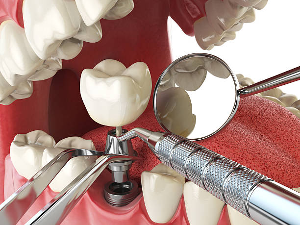 Best Tooth Pain Emergency Relief  in Portland, TX